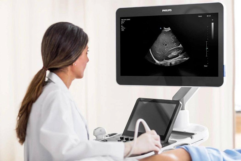 УЗИ аппарат Philips Epiq Elite Стационарный