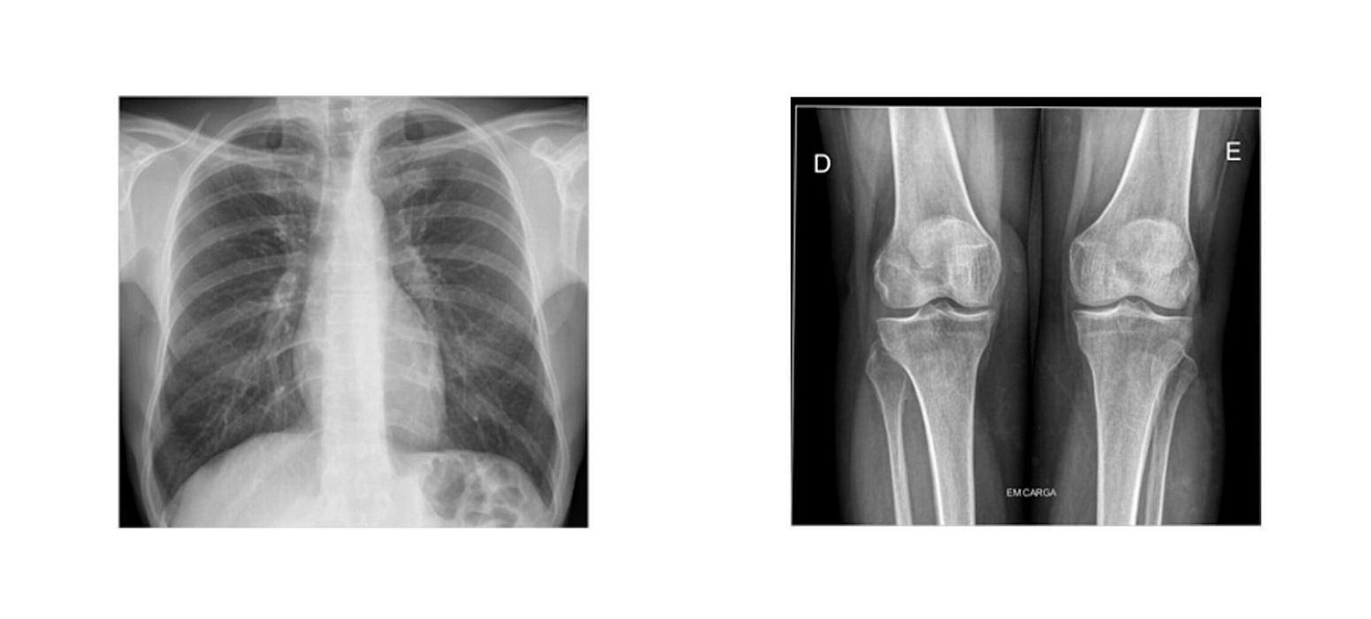 Радиографическая система DigitalDiagnost C50