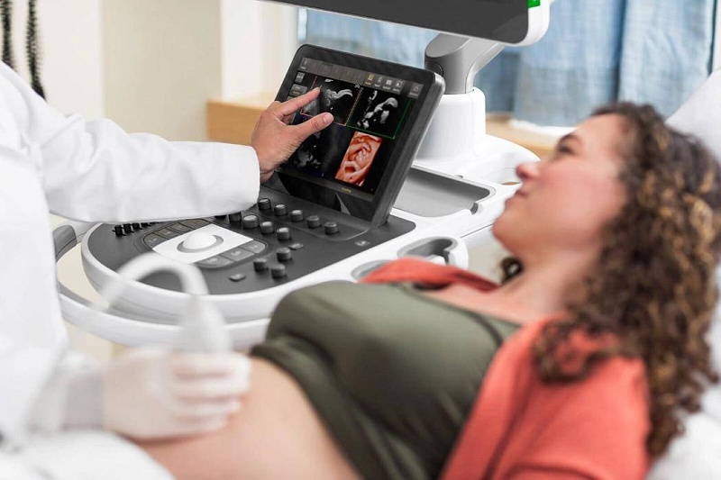 УЗИ аппарат Philips Epiq Elite Стационарный
