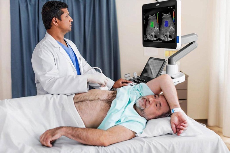 УЗИ аппарат Philips Epiq Elite Стационарный