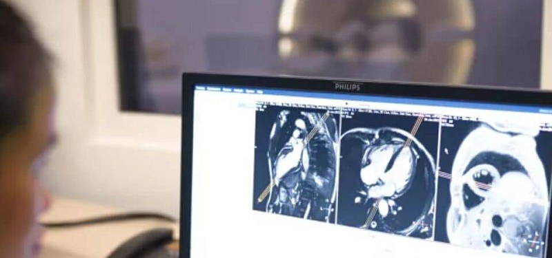 МРТ аппарат Philips Ingenia 3.0T