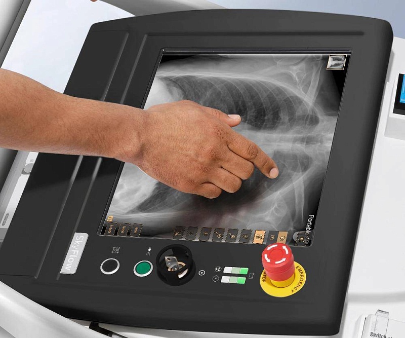 Мобильный рентген MobileDiagnost wDR