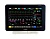 Монитор пациента Philips IntelliVue MX550