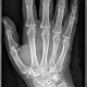 Мобильный рентген MobileDiagnost wDR